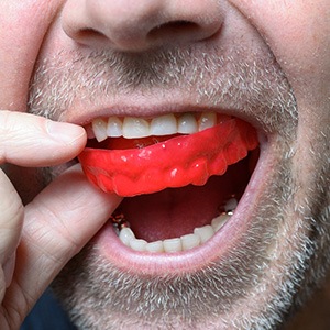 Be sure to wear a mouthguard if you play sports or grind your teeth